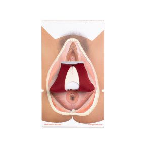 Rectovaginal fascia palpation and repair model.