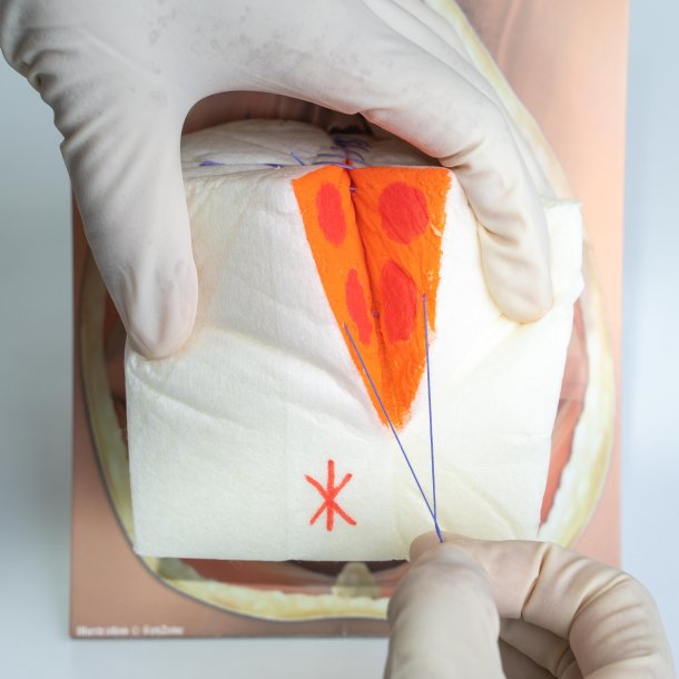 Mediolateral episiotomy repair trainer - patient's left side