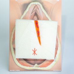 Mediolateral episiotomy repair trainer - patient's left side