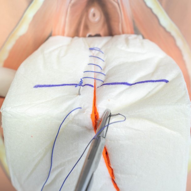 Mediolateral episiotomy repair trainer - patient's left side