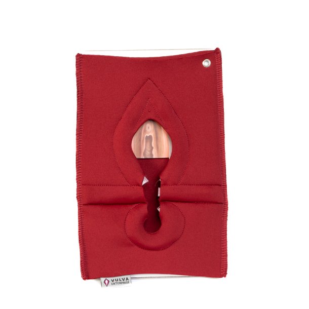 Set of 4: Palpation of superficial perineal muscles, 2nd degree trauma and anal sphincter defect 