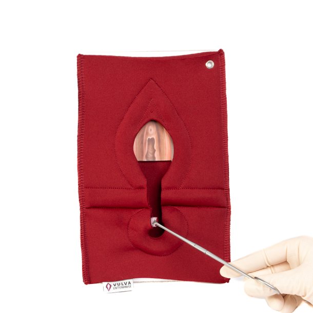 Set of 4: Palpation of superficial perineal muscles, 2nd degree trauma and anal sphincter defect 