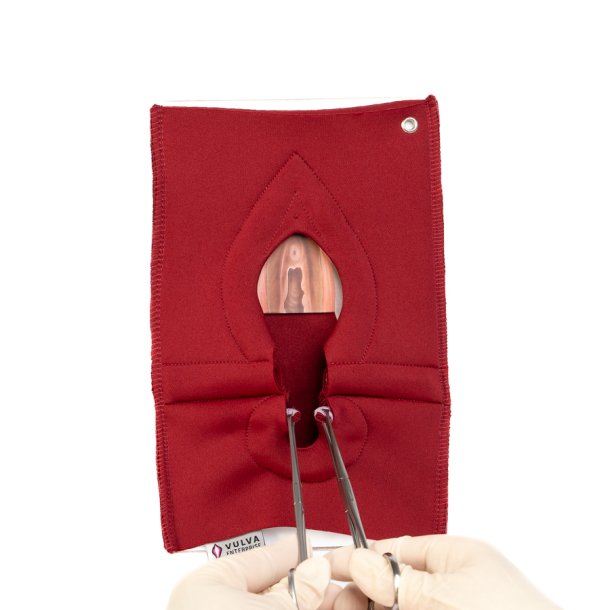 Set of 4: Palpation of superficial perineal muscles, 2nd degree trauma and anal sphincter defect 