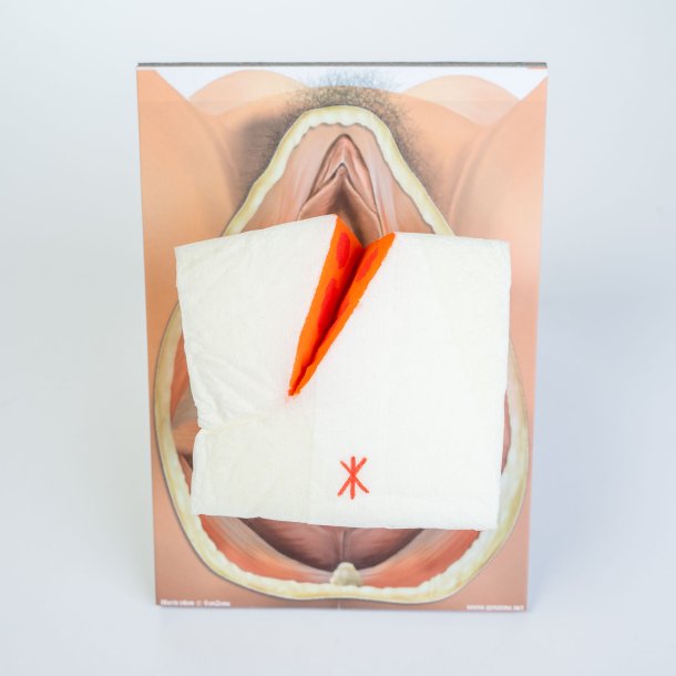 Mediolateral episiotomy repair trainer - with 2 variations. 