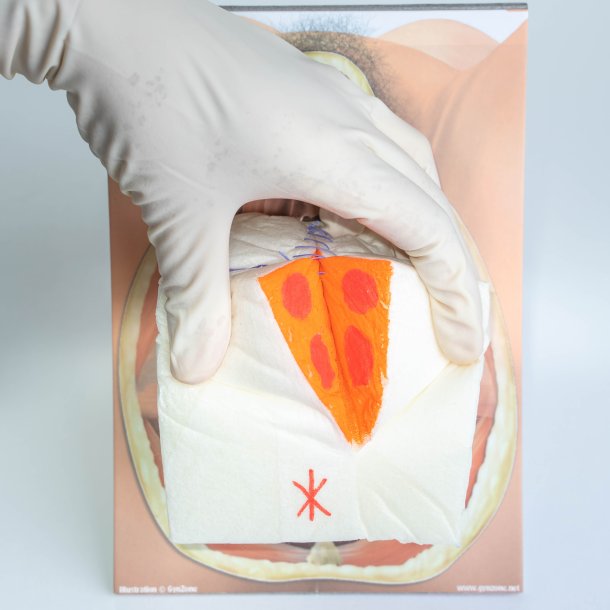 Mediolateral episiotomy repair trainer - with 2 variations. 
