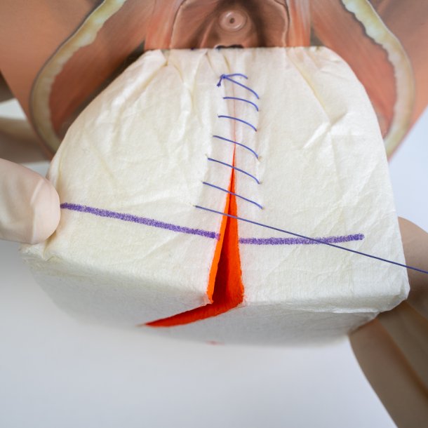Mediolateral episiotomy repair trainer - patient's right side