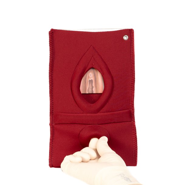 Set of 4: Palpation of superficial perineal muscles, 2nd degree trauma and anal sphincter defect 