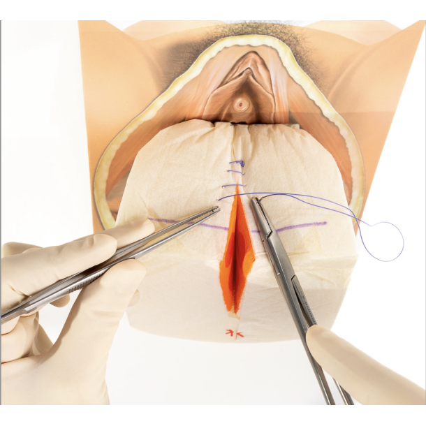 2nd degree repair trainer