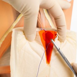 2nd degree repair trainer