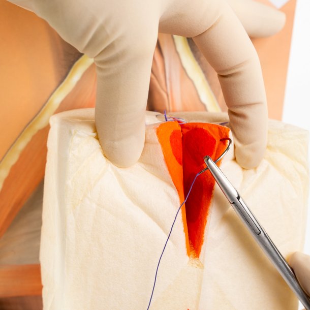 2nd degree repair trainer