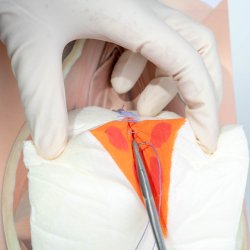 Mediolateral episiotomy repair trainer - with 2 variations. 