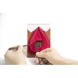 Workshop in a box. Perineal repair of 1st 2nd-degree and mediolateral episiotomy