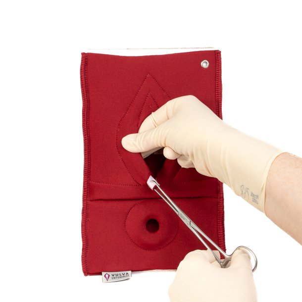 Set of 4: Palpation of superficial perineal muscles, 2nd degree trauma and anal sphincter defect 