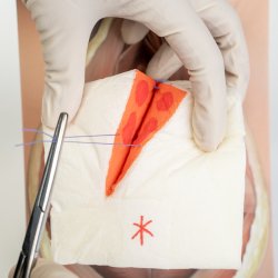 Mediolateral episiotomy repair trainer - patient's right side