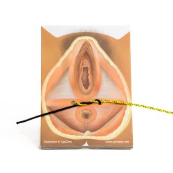 Basic Surgical Skills Suture Kit