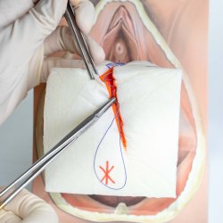 Mediolateral episiotomy repair trainer - patient's left side