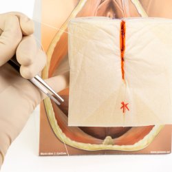 2nd degree repair trainer