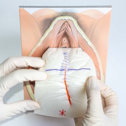 Mediolateral episiotomy repair trainer - patient's left side