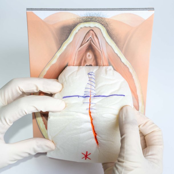 Mediolateral episiotomy repair trainer - patient's left side