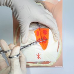 Mediolateral episiotomy repair trainer - patient's left side