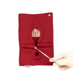 Set of 4: Palpation of superficial perineal muscles, 2nd degree trauma and anal sphincter defect 