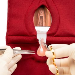 Anal Sphincter Repair Model, Textile