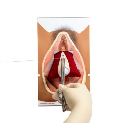 Rectovaginal fascia palpation and repair model.