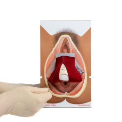 Rectovaginal fascia palpation and repair model.