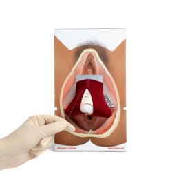 Rectovaginal fascia palpation and repair model.