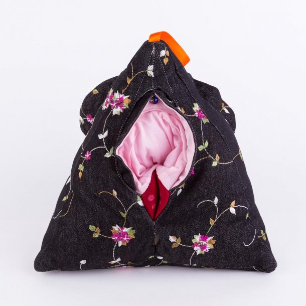 Birth Trauma Triangle (episiotomy to patient's left side)