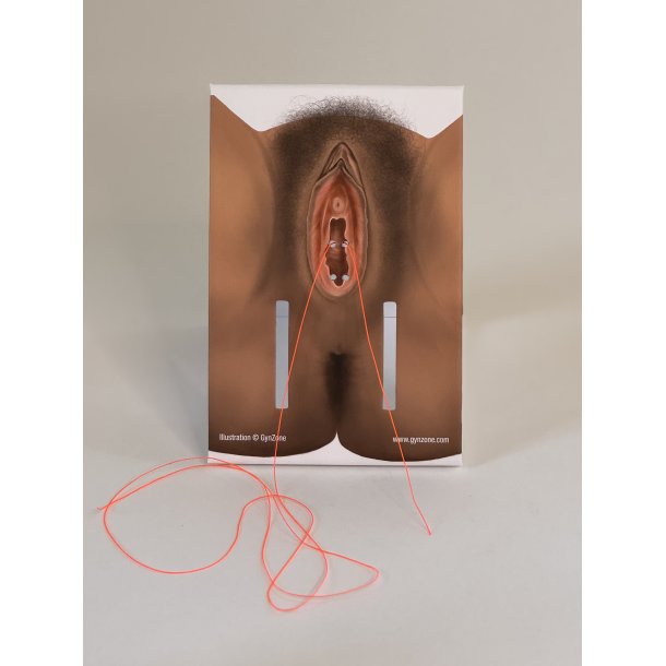 1st-degree repair model