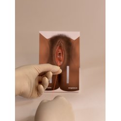 1st-degree repair model