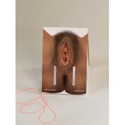 1st-degree repair model