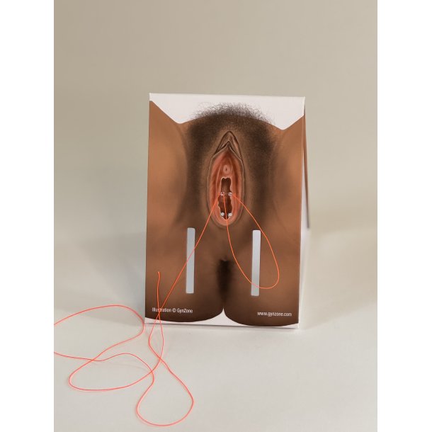 1st-degree repair model