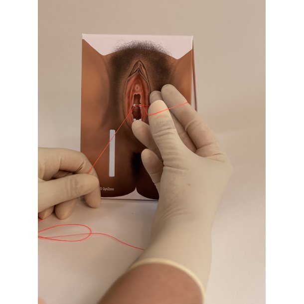 1st-degree repair model