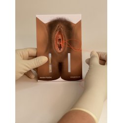 1st-degree repair model