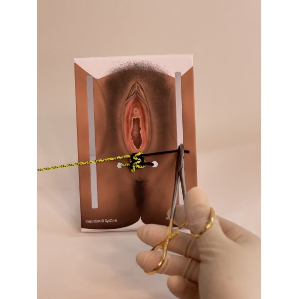 1st-degree repair model