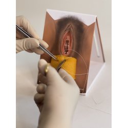 1st-degree repair model