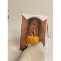 1st-degree repair model