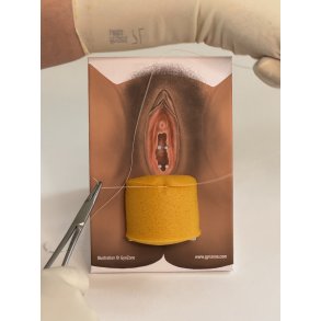 1st-degree repair model