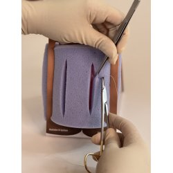 1st-degree repair model