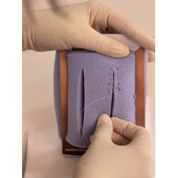 1st-degree repair model