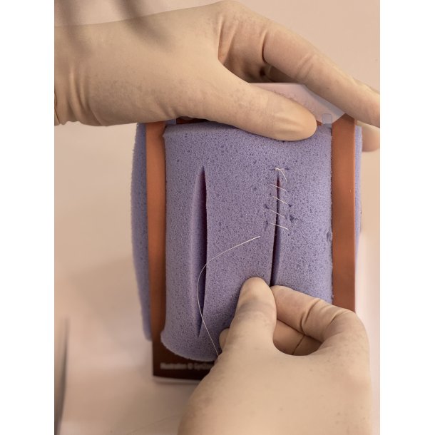 1st-degree repair model