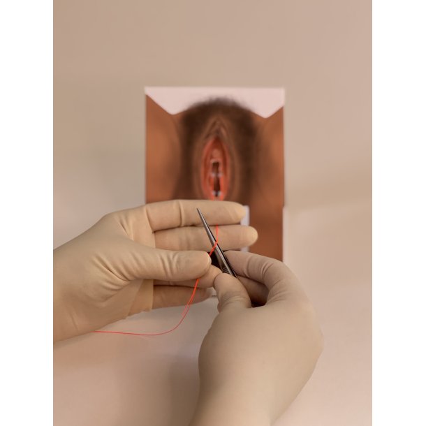 1st-degree repair model